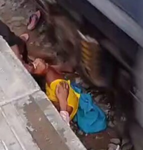 Heroic Bihar Mother Injured While Shielding Children from Train at Shahpur Patori Heroic Bihar Mother Injured While Shielding Children from Train at Shahpur Patori